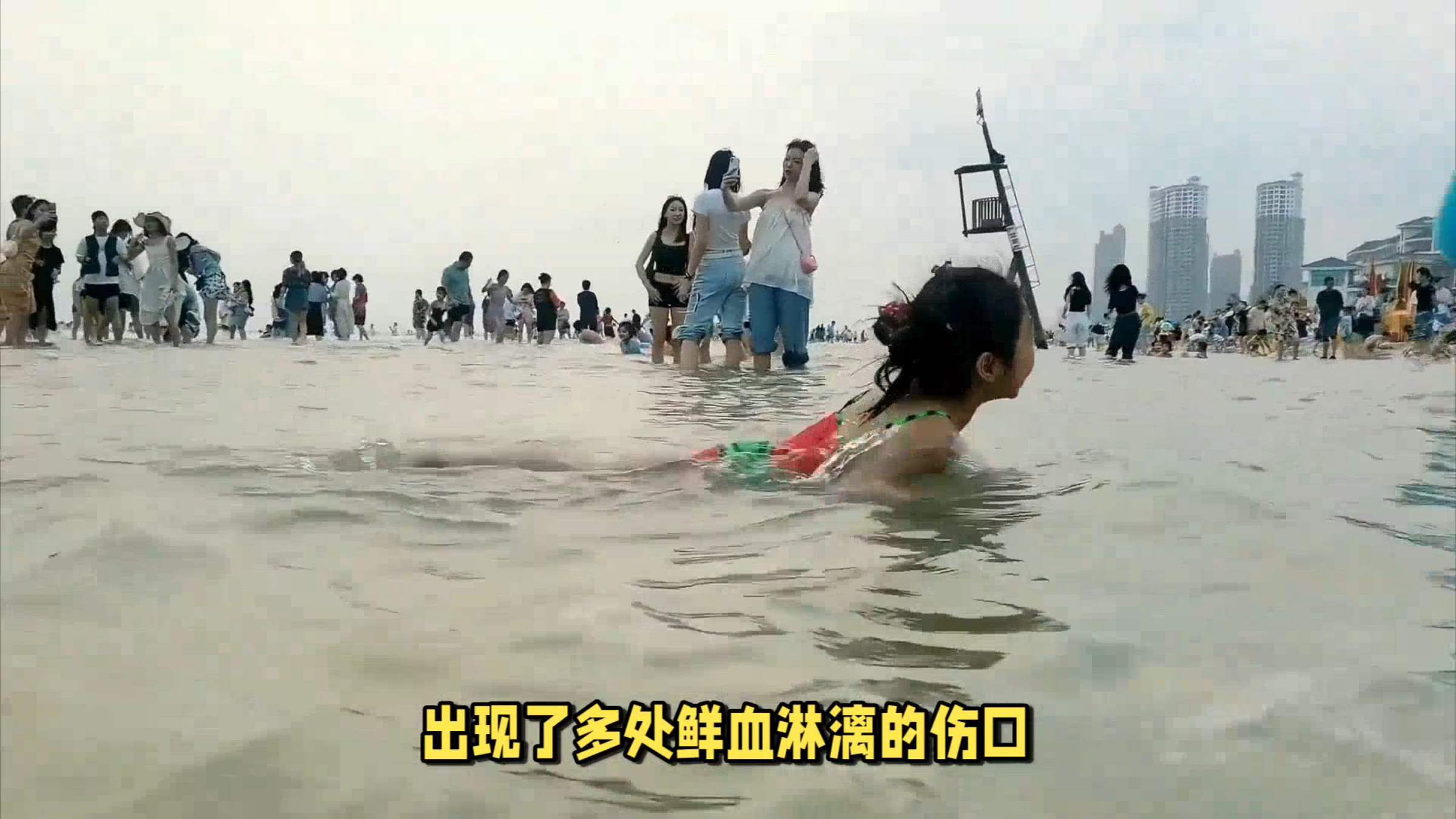 北海多名游客被不明鱼类咬伤 网友讲述潜水被咬:很疼,伤口很深