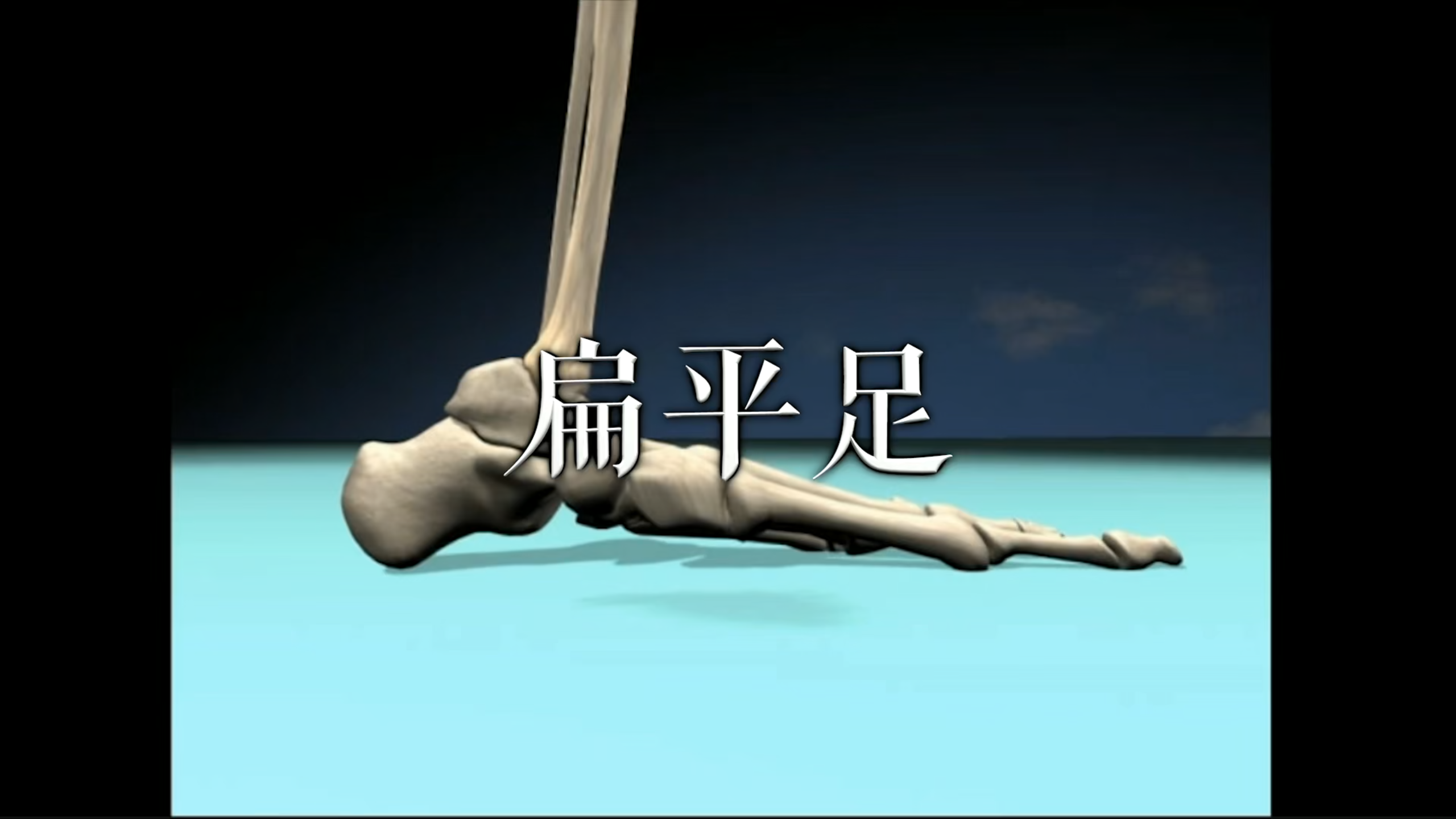 肌肉动作解剖|扁平足