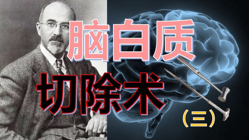 【科学八卦史】一个精神病医生是怎么酿成近代最大医学惨剧的 3,历史,世界历史,好看视频
